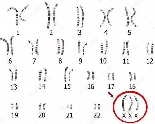 济南医院代生男孩,济南试管婴儿大约多少钱啊，多少13708元