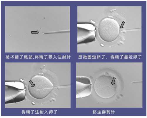 济南知名供卵机构排名揭晓！2025借卵价格标准分享